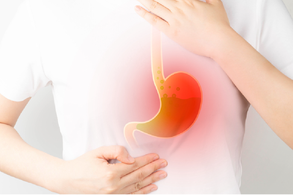 Navigating Gastric Problems: Causes, Symptoms, Treatment, and Prevention