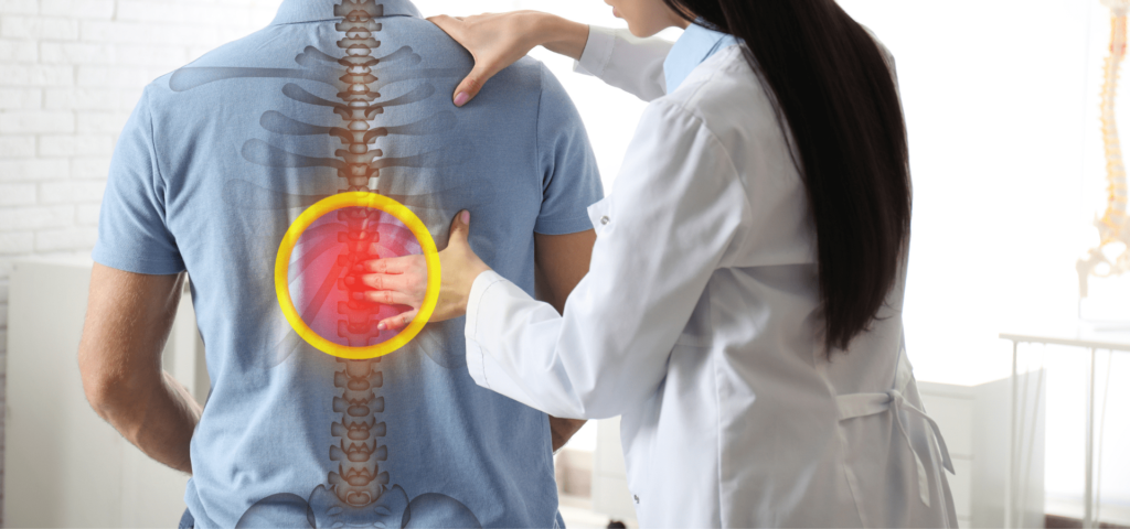 Effective L5 S1 Disc Bulge Treatment: Symptoms, Causes, and Solutions