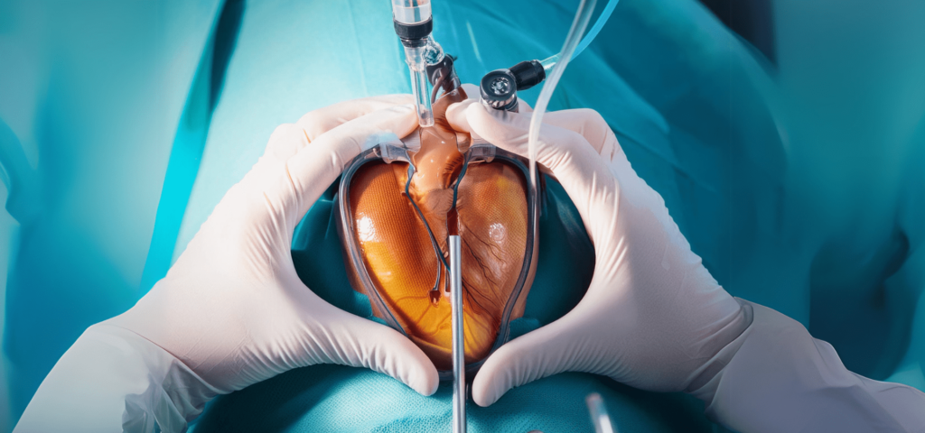 Heart Stent Operation: A Comprehensive Overview of the Procedure