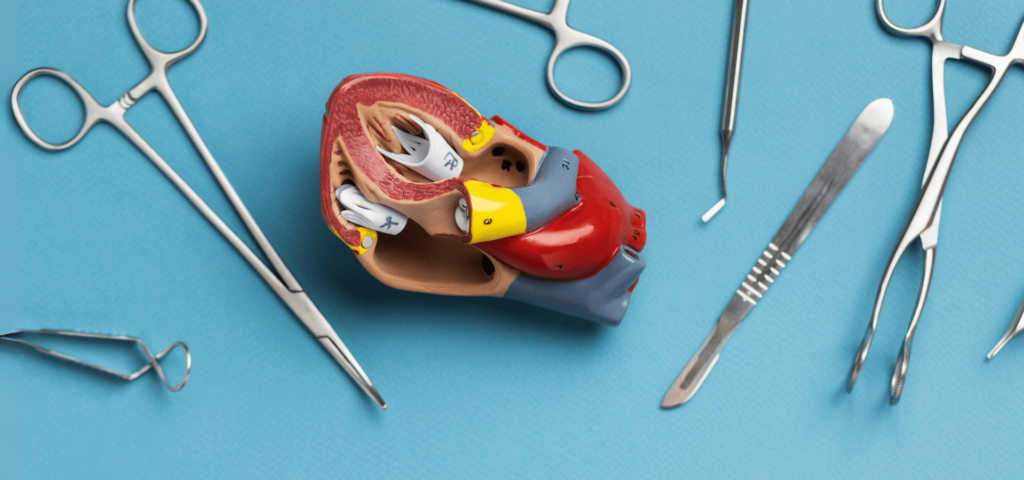 Understanding Carotid Endarterectomy: Benefits and Recovery Insights