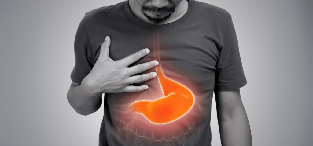 Understanding Esophageal Ulcer: Symptoms, Causes, and Treatments
