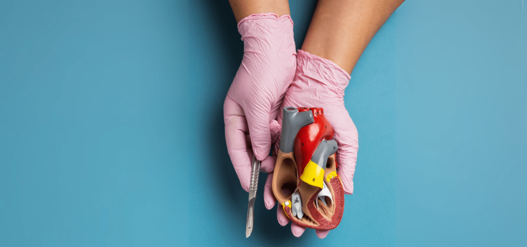 Understanding TEVAR: A Guide to Thoracic Endovascular Aneurysm Repair