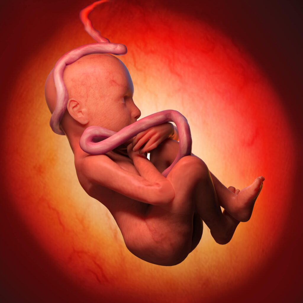 Fetal Anemia