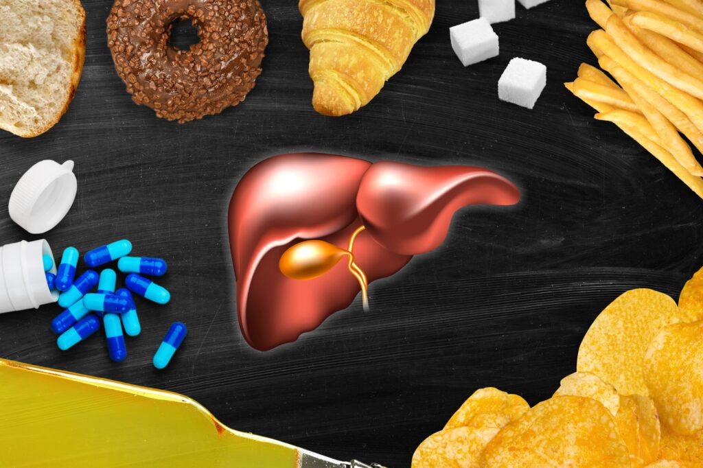 Transform Your Health: Overcoming Non-Alcoholic Fatty Liver Disease