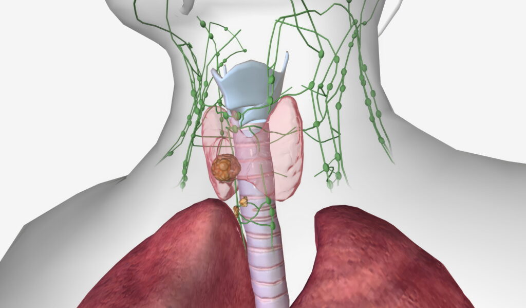 Esophageal Varices: What Happens When Blood Flow Is Blocked
