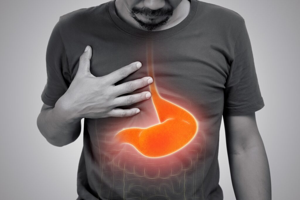 What is Antral Gastritis and Why Gut Experts Treat it Differently