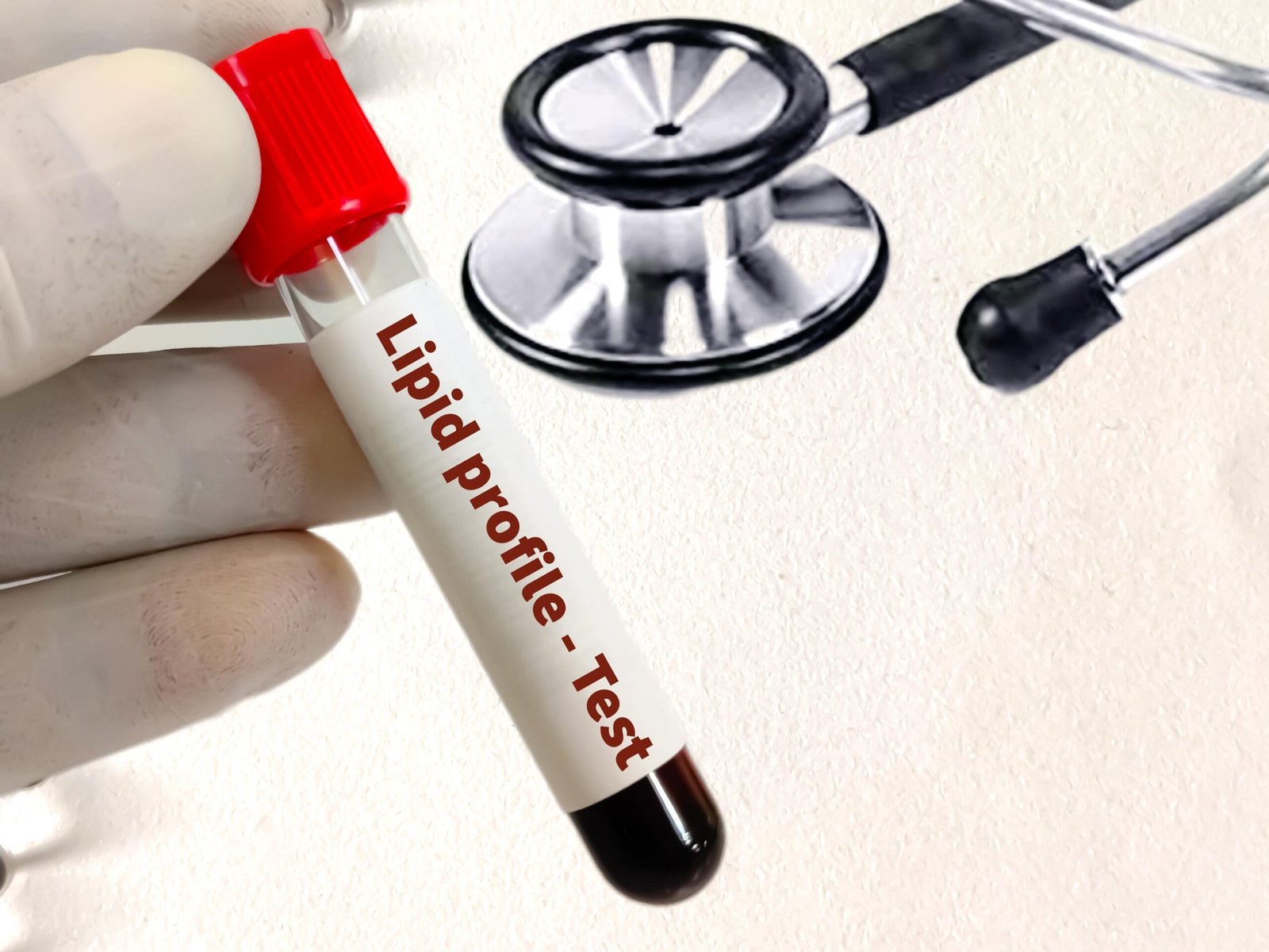 Lipid Profile Test: What It Measures & How to Interpret Results
